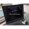 DW-C60 DAWEI Portable Laptop 4D Color Doppler Ultrasound System Machine Factory Price with CE ISO Approval